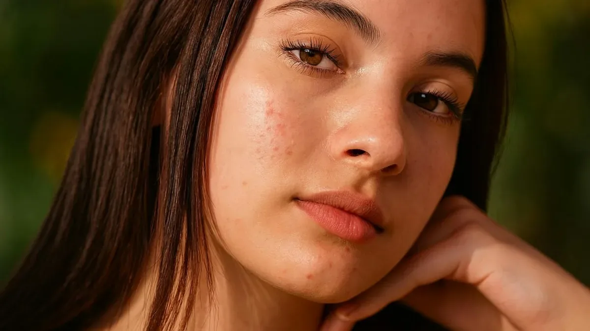 creme solaire anti tache visage — Crème solaire anti tache visage : explications et repères